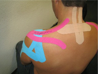 Kinesio